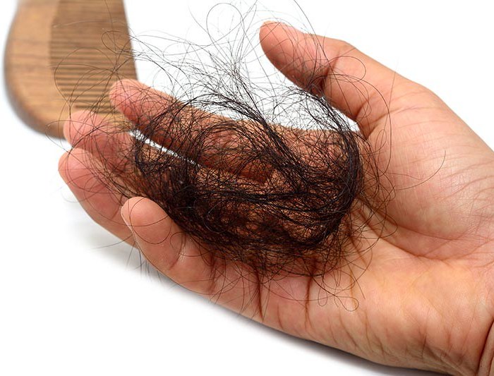 The Factors Affecting Hair Loss and Their Treatment